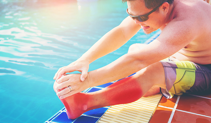What Is The Most Common Cause Of Swimming Pool Accidents? 